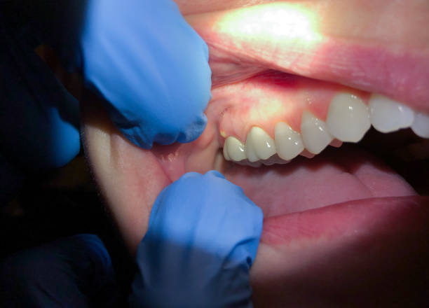 Best Urgent Dental Care for Toothache in Lewisburg, TN